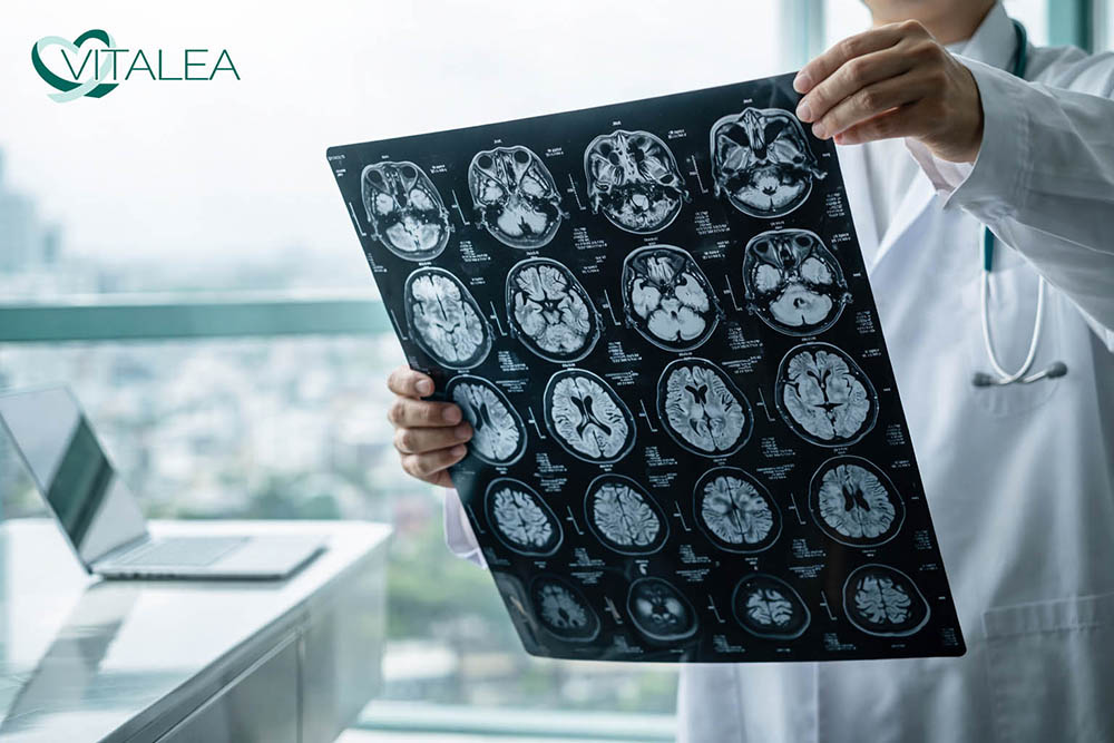 Memóriazavar és demencia