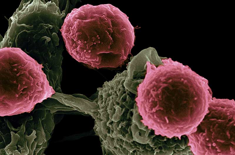 Vastagbél daganatok kivizsgálása
